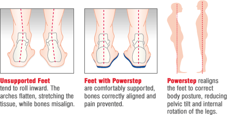 How Powerstep works